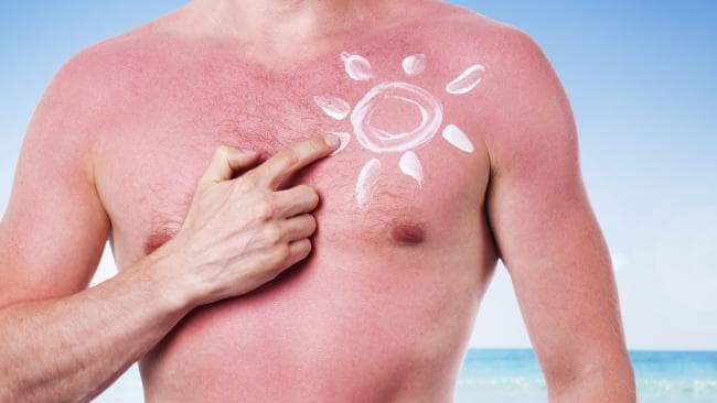 Victoria's alarming sunburn problem