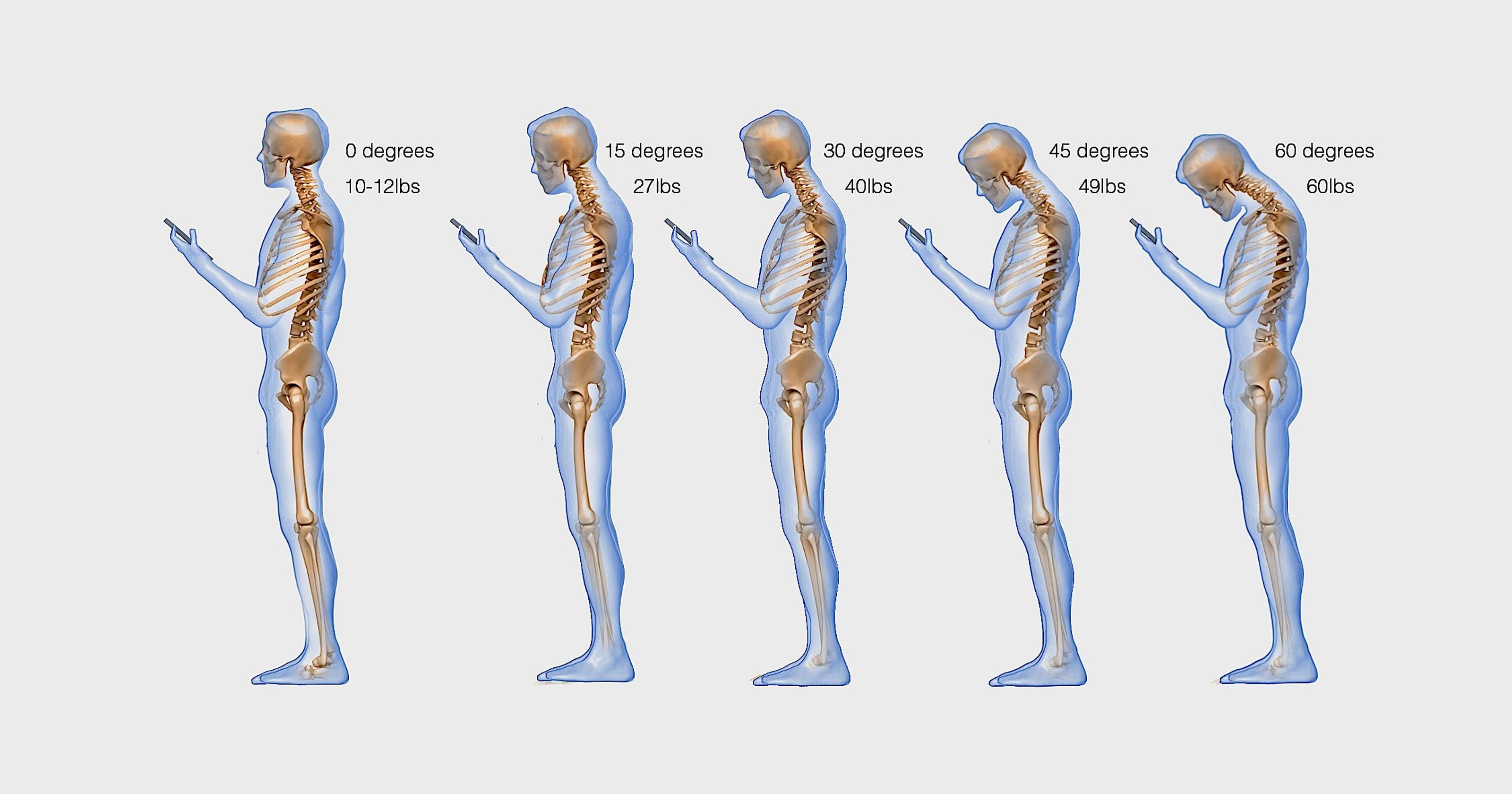 chronic neck and back pain 