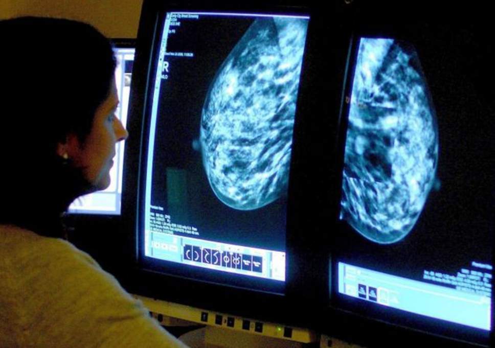 'Smart drug' offers hope to breast cancer sufferers