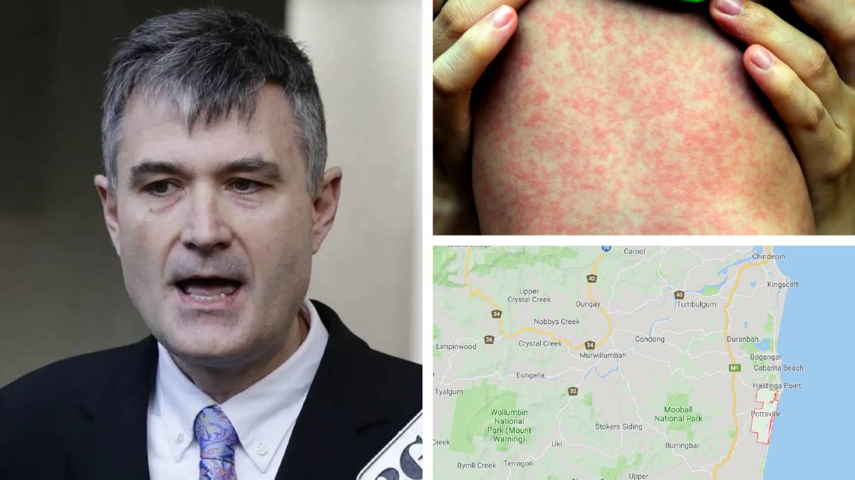 Measles warning issued for NSW north coast