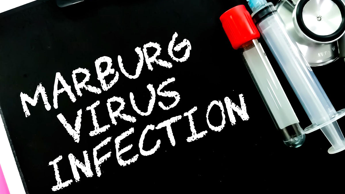 vi-rút Marburg